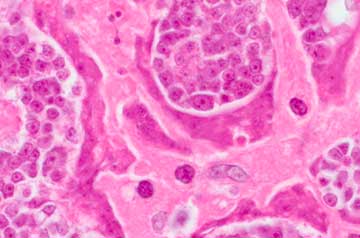 Показать фото 18+