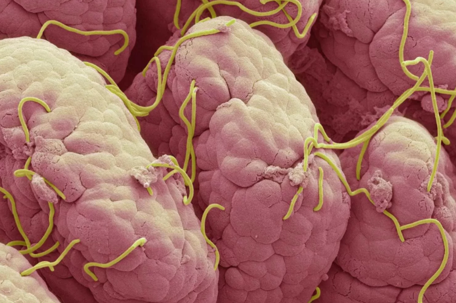 Показать фото 18+